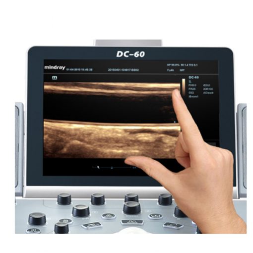 4D Color Doppler Ultrasound System Mindray DC-60