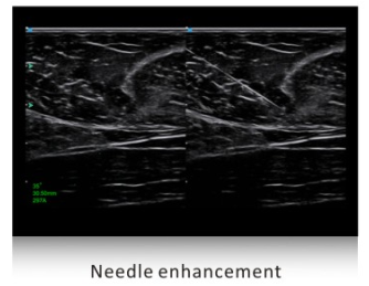 SIUI Ultrasound Apogee 5500(1)