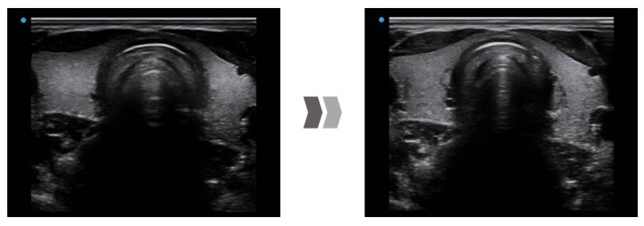 SIUI Ultrasound Apogee 5500(2)