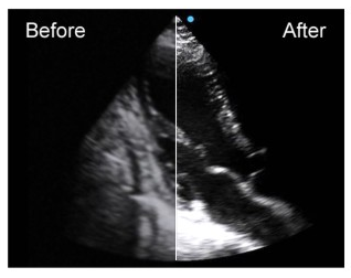 SIUI Ultrasound Apogee 5500(4)