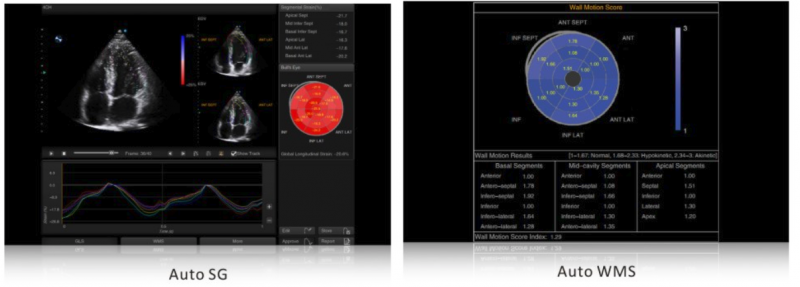 SIUI Ultrasound Apogee 5500(5)