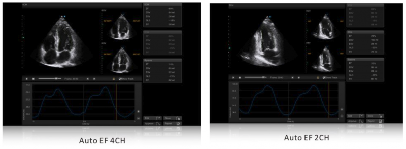 SIUI Ultrasound Apogee 5500(6)