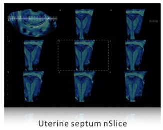 SIUI Ultrasound Apogee 5500(8)