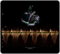 SIUI Ultrasound System Apogee 3300 Neo (4)