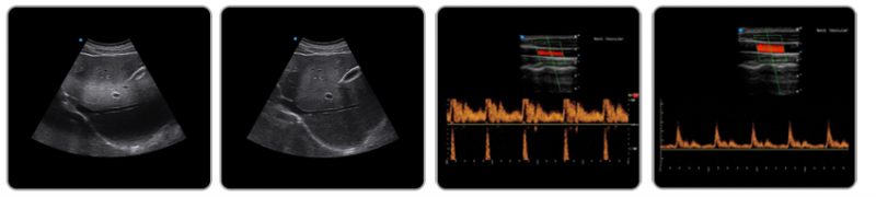 SIUI Ultrasound System Apogee 3300 Neo A