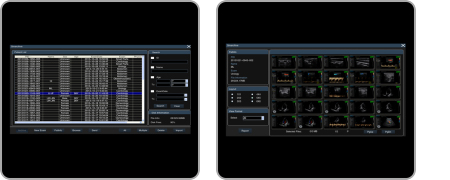 SIUI Ultrasound System Apogee 3300 Neo B