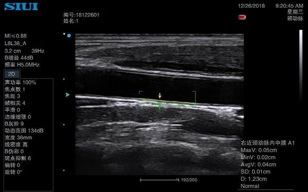 CTS-4000 Digital 4D Color Ultrasound Machine 