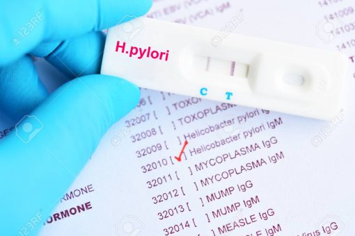 105154299 h pylori positive test result by using rapid test cassette