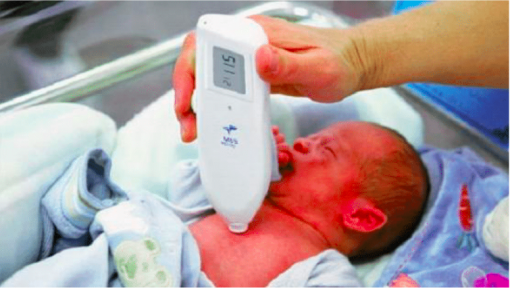 Anjue MBJ20 Handheld Rapid Test Jaundice Meter