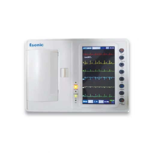 6 channel ECG 01