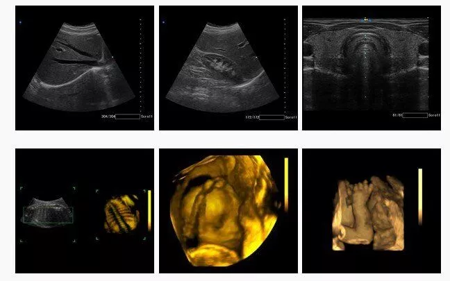 SIUI CTS-5000 Digital 4D Color Doppler Ultrasound Machine