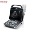 mindray-dp-25-power-digital-ultrasonic-imaging-system