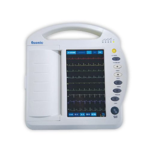 esonic 12 channel ecg