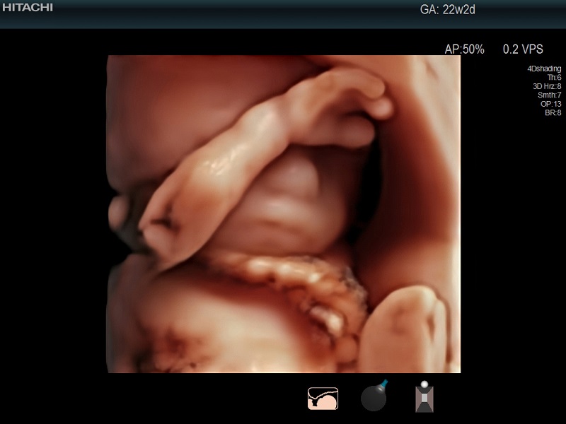 AR750 High definition 3D baby face